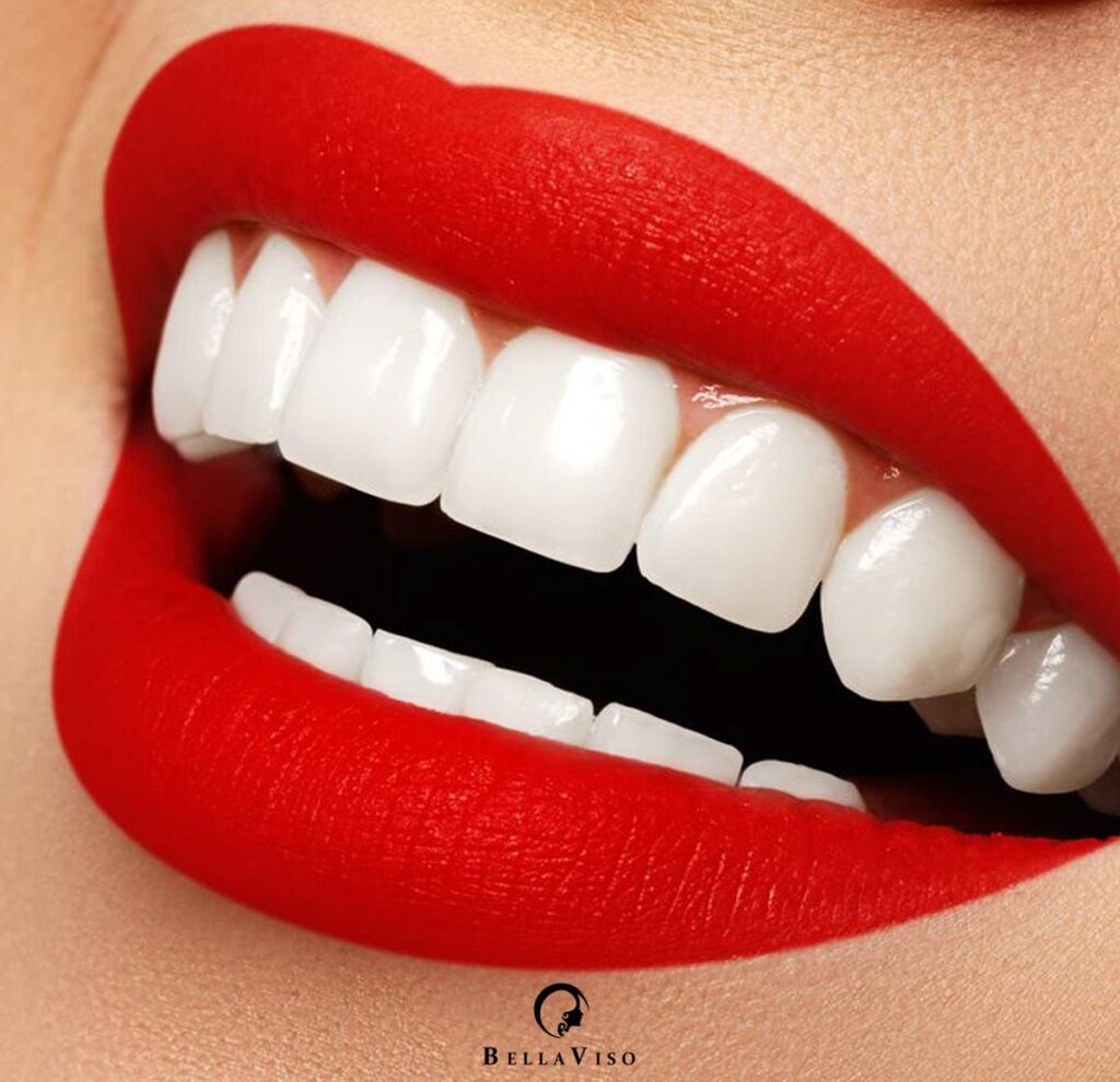 Best Teeth Cleaning Clinic in Dubai