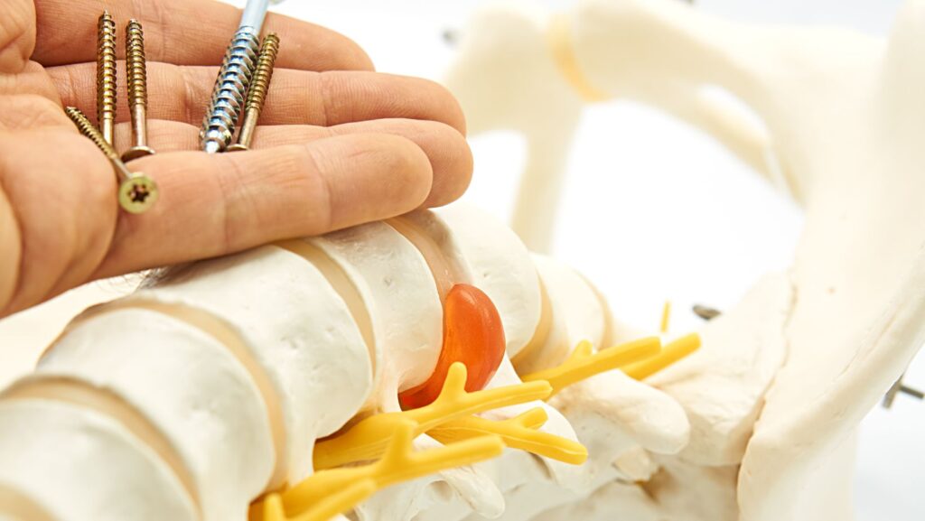 Balancing Risks and Benefits Patient Selection for Complex Spine Surgeries