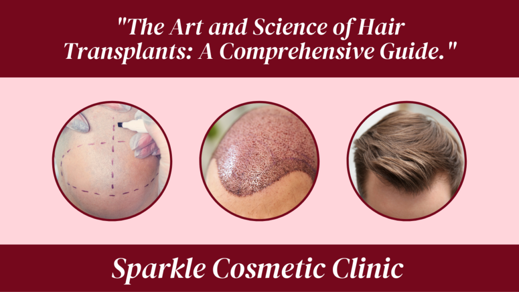 The Art and Science of Hair Transplants A Comprehensive Guide.