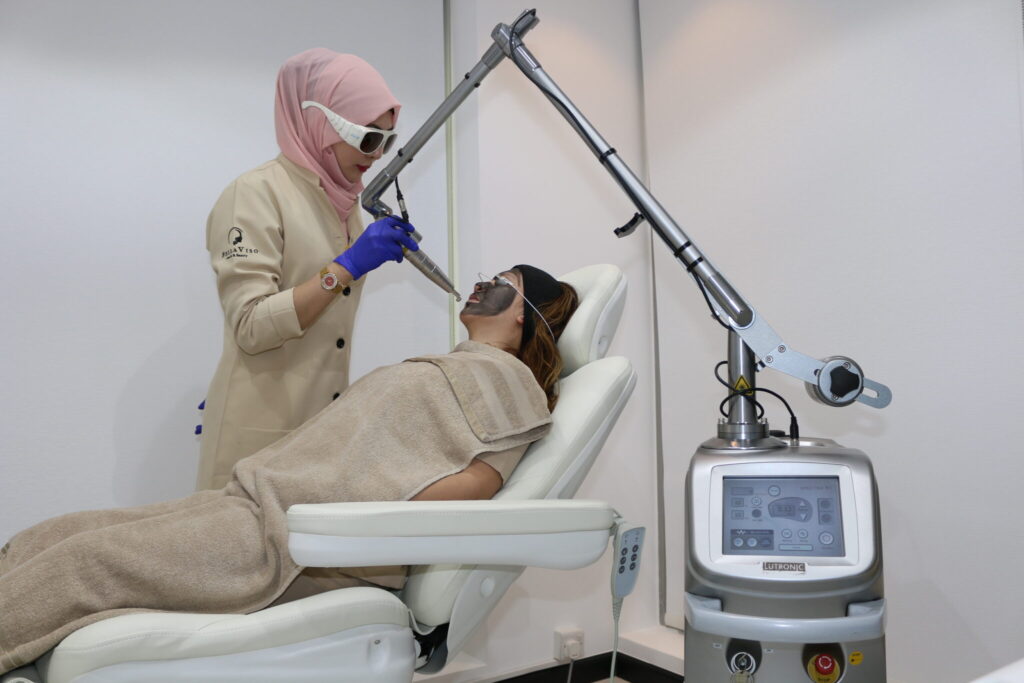 Carbon Peel Laser Treatment in dubai