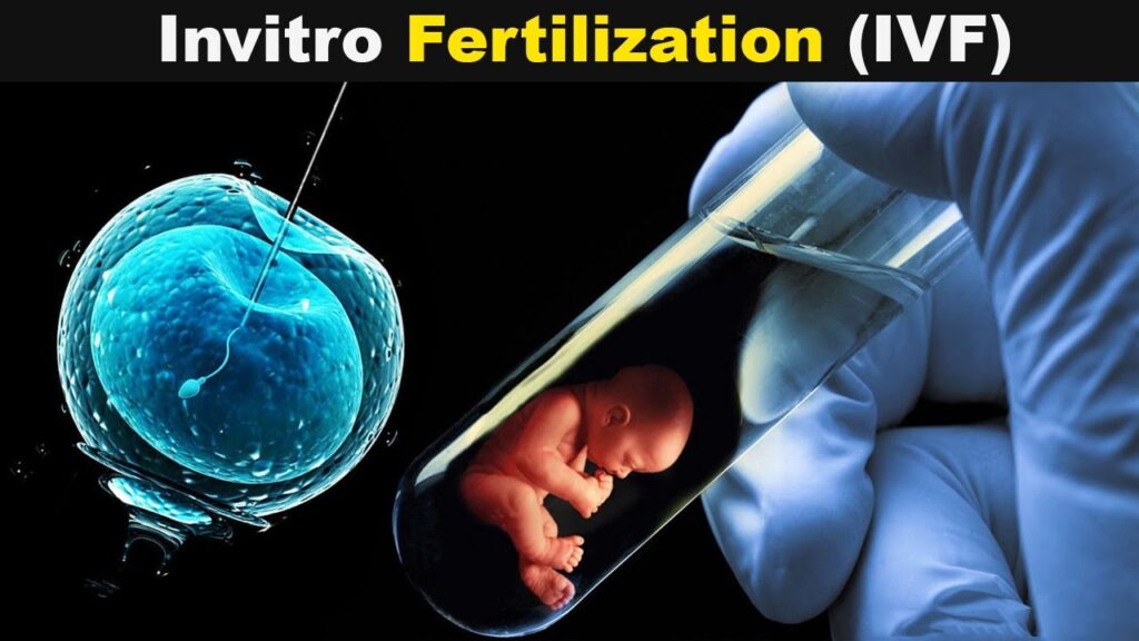 IVF Treatment