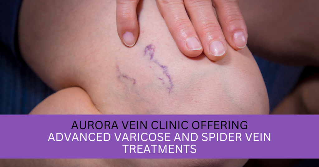 Aurora Vein Clinic