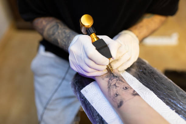 laser tattoo removal in Abu Dhabi