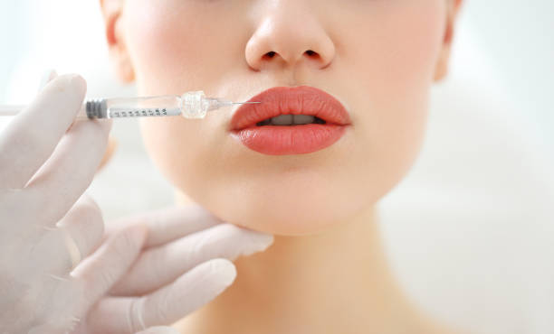 Russian lip fillers in Abu Dhabi