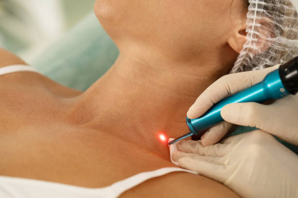 Laser pigmentation treatment costs in Abu Dhabi