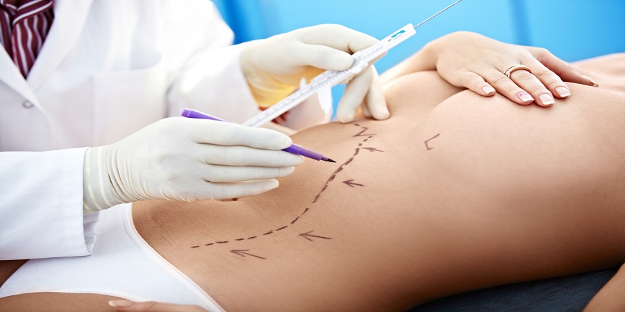 Shaping the Future: The Latest Advances in Liposuction Surgery in Dubai