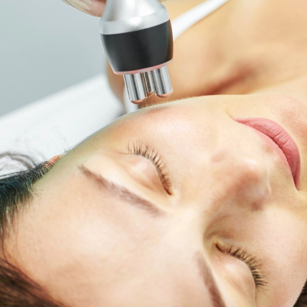 Radiofrequency Treatment