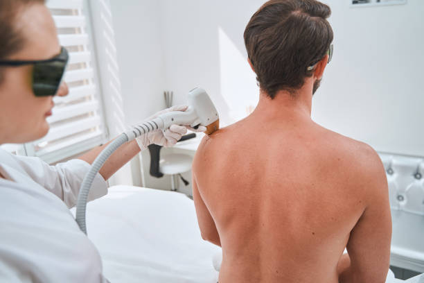 Men’s Laser Hair Removal Abu Dhabi