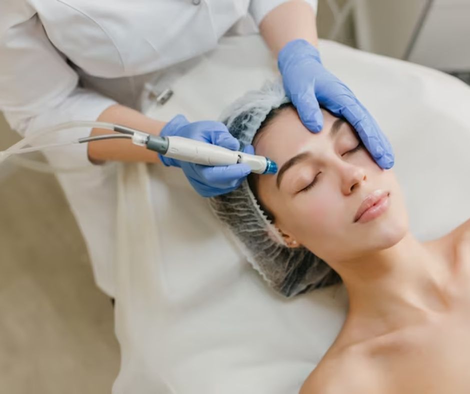 Microneedling