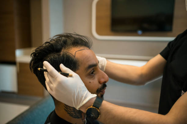 تكلفة زراعة الشعر في أبوظبي