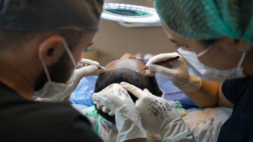 Hair Transplant in Abu Dhabi