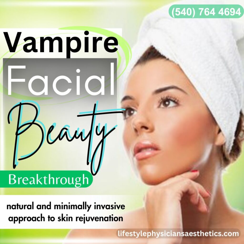 Vampire Facial Culpeper