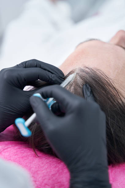 PRP Hair Treatment in Abu Dhabi