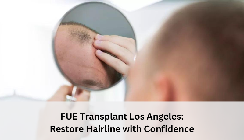 fue transplant Los Angeles