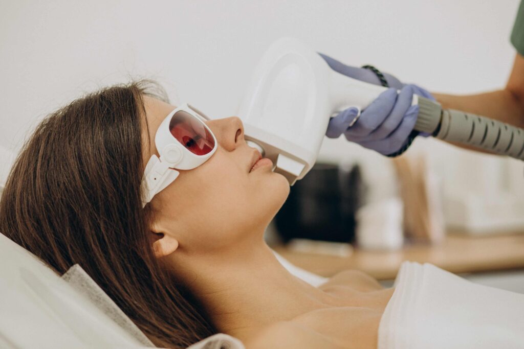 laser facial hair removal