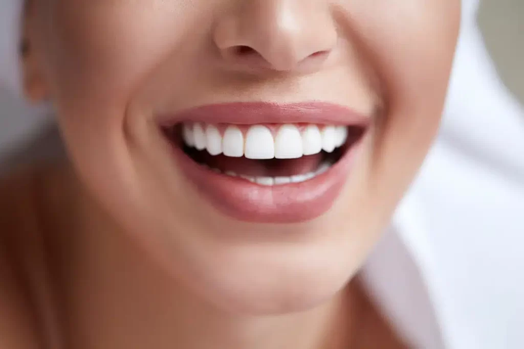 natural teeth whitening